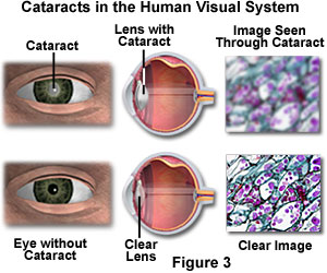 奧林巴斯顯微鏡 human vision figure3