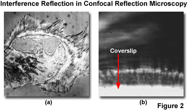 奧林巴斯顯微鏡 reflectedconfocalfigure2